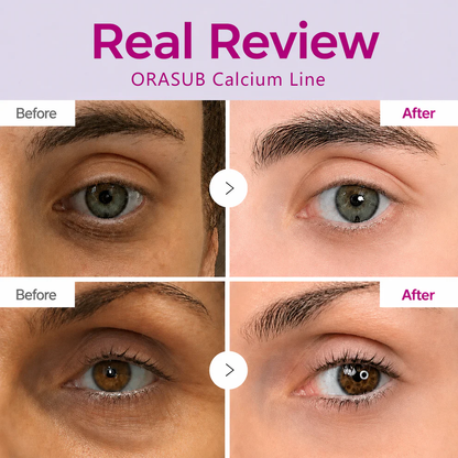 🔥LAST DAY 60% OFF!!ORASUB Korean Calcium Dark Spot Eye Cream