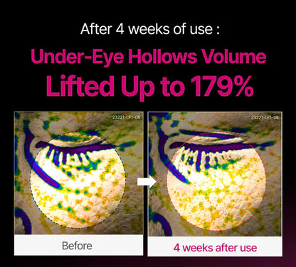 🔥LAST DAY 60% OFF!!ORASUB Korean Calcium Dark Spot Eye Cream