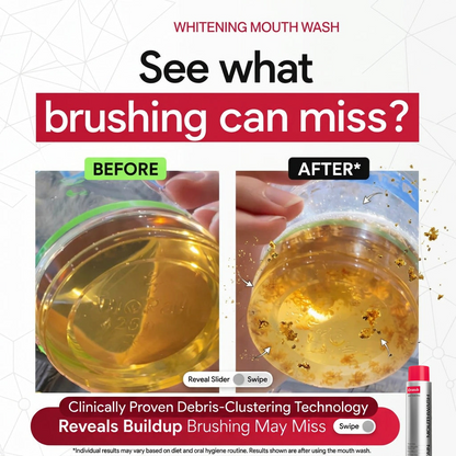 Orasub Stain Whitening Mouthwash